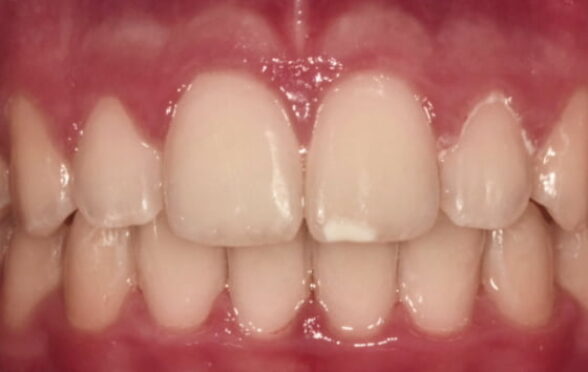 After -Bollington Dental Practice