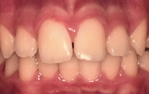 Before - Bollington Dental Practice